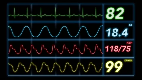Enhance Your EKG Practice with Expert Insights